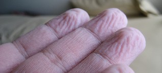 Feuchte Finger bieten nur Vorteile für Briten – Oder: Warum Hand und Fuß wirklich schrumpeln [1]