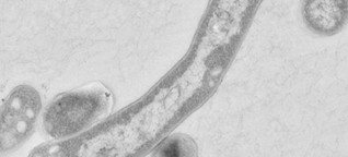 Zwangsquarantäne für Tuberkulose-Kranke: Rückkehr auf den Zauberberg