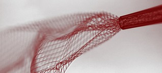 Nanotechnologie: Elektrodennetz ins Hirn gespritzt