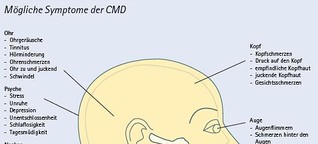 Was sind eigentlich CMD - craniomandibuläre Dysfunktionen?