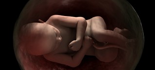 Wie künstliche Plazentas Frühgeborenen helfen könnten
