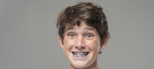 Zahnspangen: Für Kinder normal, für Eltern teuer - WELT