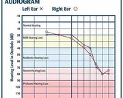 What is Audiogram?