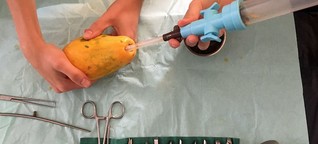 Abtreibung: Üben an einer Papaya