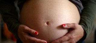 Why the United States has a high rate of maternal mortality