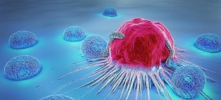 Breast Cancer Rising Threat to Women. [1]