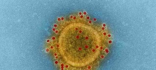 Wie gefährlich ist der Coronavirus?