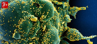 Eine Million Tote: War die „Russische Grippe" eine Corona-Pandemie?