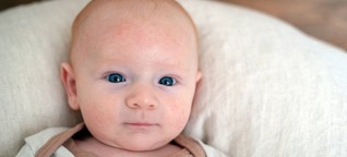 Was tun bei Neurodermitis bei Babys und Kleinkindern?