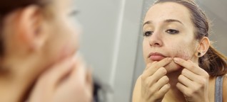 Hautkrankheit: Was gegen Akne hilft