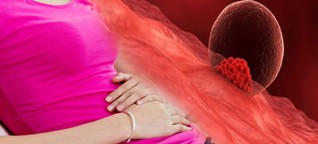 What is Implantation bleeding during pregnancy? How to distinguish between implantation bleeding and menstrual bleeding