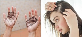 7 Ways To Tell If Your Hair Is Shedding More Than Normal