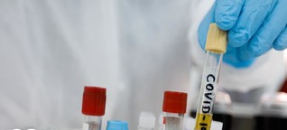 Impfstoffsuche: Mit Hefezellen gegen Corona (2020)