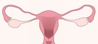 Causes Womb Wall Thinning Symptoms and Treatment