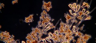 Schönheiten in einer Kläranlage : Mikroorganismen reinigen das Wasser
