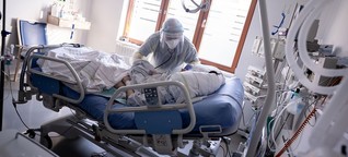 Hospitalisierungsrate unterschätzt Patientenzahlen dramatisch