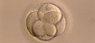 Embryonenschutzgesetz - wann kommt die Reform?